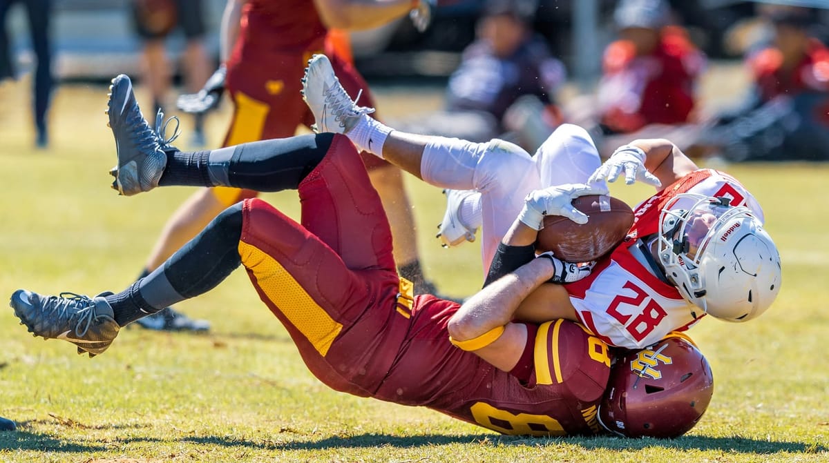 Auch! Repeated head trauma changes brain chemistry in former football players
